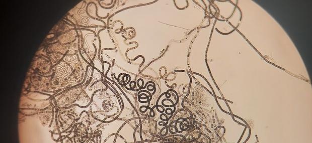 Billede af cyanobakterier samlet og undersøgt i Tejn lagune i forbindelse med algeopblomstring